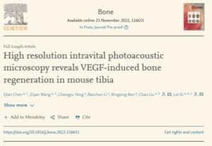 Read more about the article 恭喜王紫嫣的文章在Bone接收