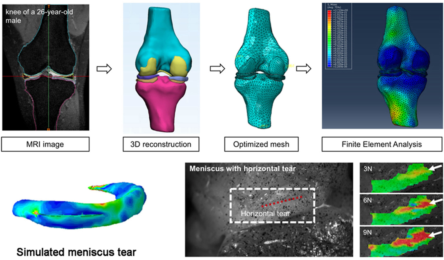 You are currently viewing Bingtong’s paper accepted at Mechanobiology in Medicine!